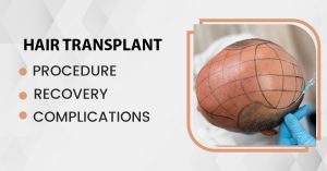Read more about the article Hair Transplant: Procedure, Recovery, Complications, and More