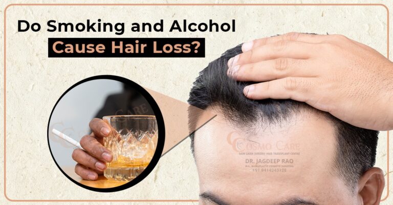 Do Smoking and Alcohol Cause Hair Loss?