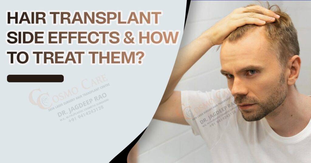 Hair Transplant Side Effects