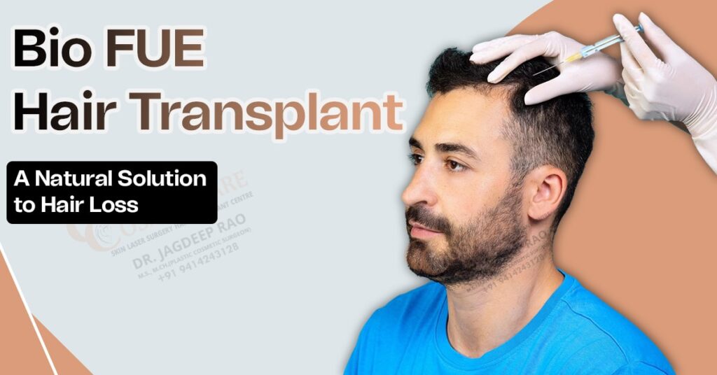 Bio FUE Hair Transplant in Jaipur