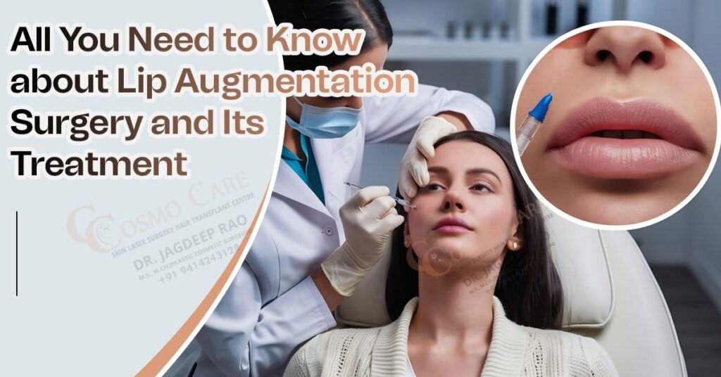Lip Augmentation Surgery