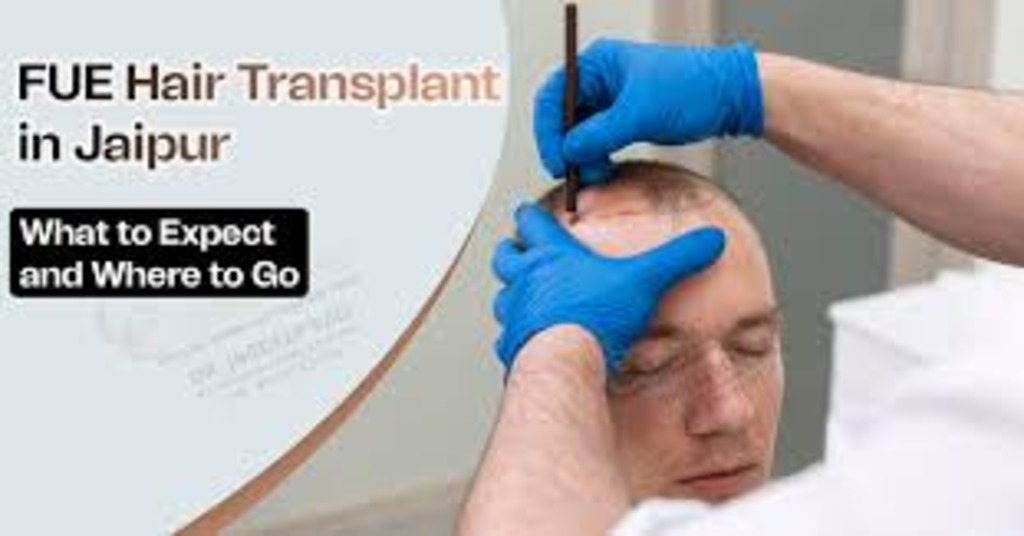 Best Hair Transplant Doctor in Jaipur