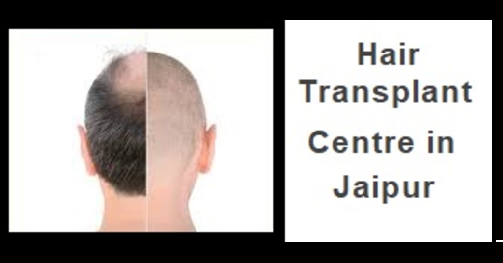 Hair Transplant Centre in Jaipur