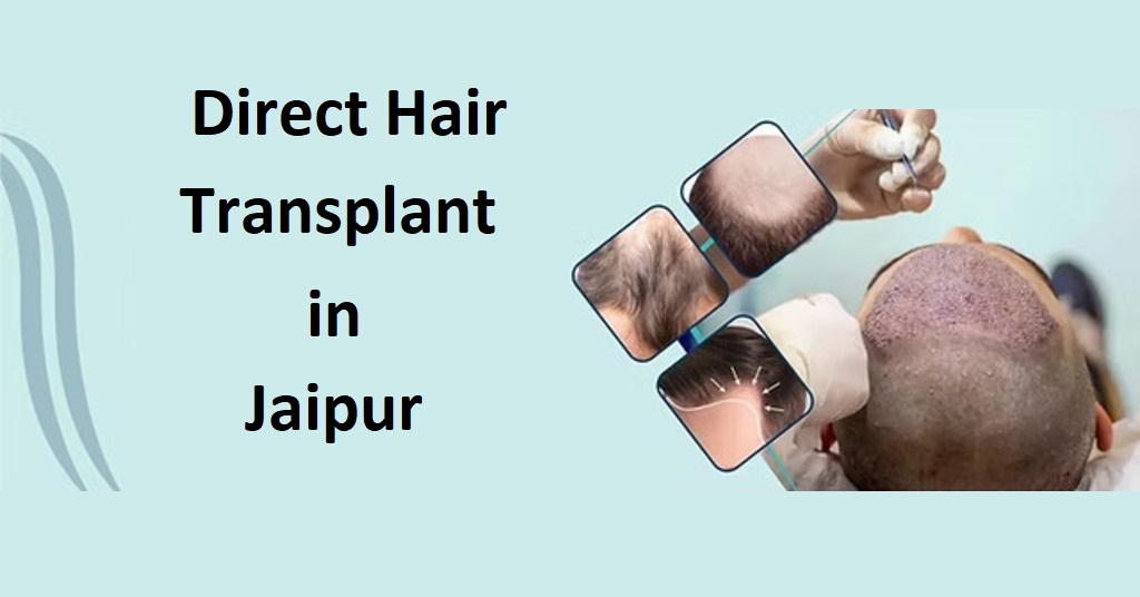 Direct Hair Transplant in Jaipur