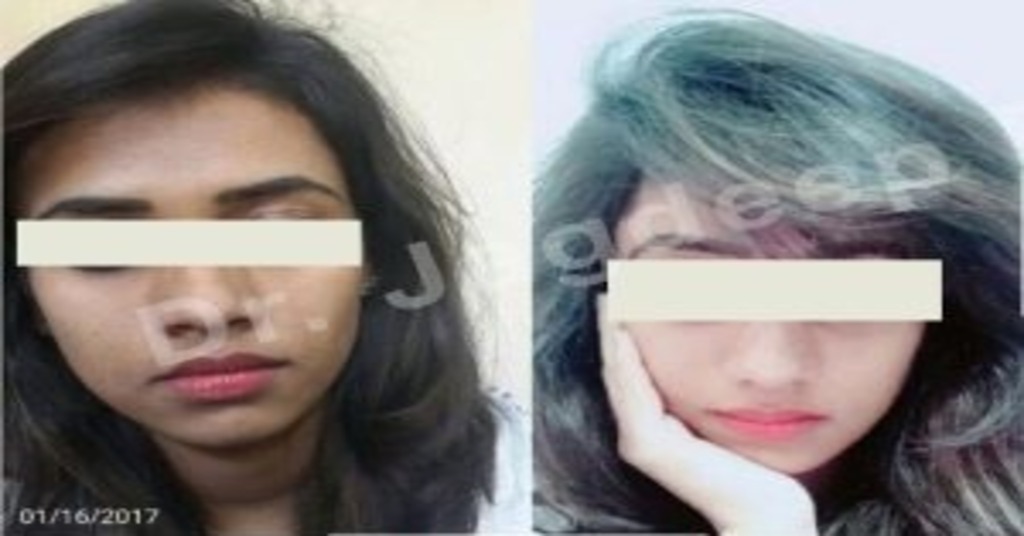 Rhinoplasty Clinic in Jaipur