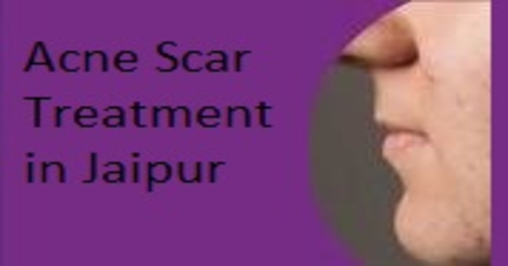 Acne Scar Treatment in Jaipur